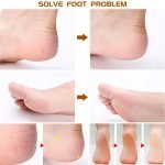 Foot Care Pedicure Tools - Image 9