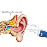 Find Back Easy Earwax Removal Simple Twist - Image 3