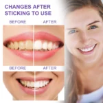 Teeth Freshener Whitening - Image 3