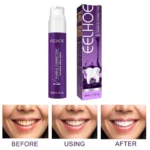 Teeth Freshener Whitening - Image 10