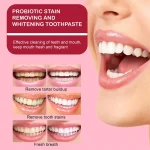 Sp4 Teeth Whitening Toothpaste Tooth - صورة 3