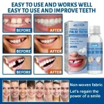 Resin Tooth Repair Glue Shapeable - صورة 3