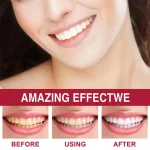 Sp4 Teeth Whitening Toothpaste Tooth - صورة 5