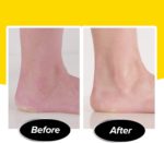 Electric Callus Remover - صورة 5