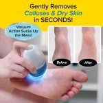 Electric Callus Remover - صورة 12