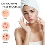 Acne Pimple Patch Invisible - صورة 2